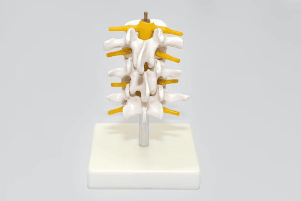 Lumbar Nerve Root Compression Treatment In Bangalore
